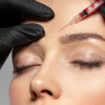 Tratamiento con Botox en Quito